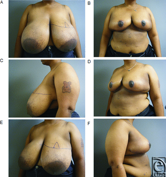 david kang add mature empty tits photo