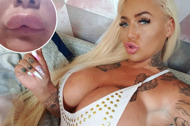 chris willden add plastic surgery porn photo