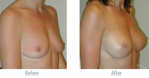debora glenn add big firm titts photo