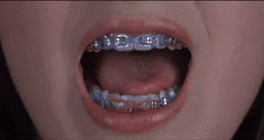 debbie salangsang add bj braces photo