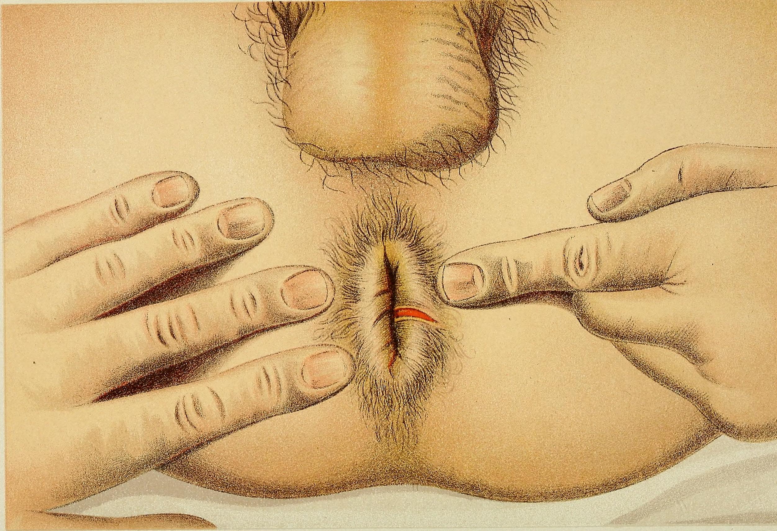 bob ardiel add anal tumblr photo