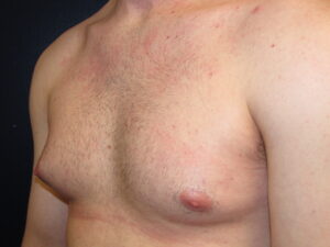 chris gardipee add fat tittes photo