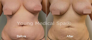 andrea hampton add natural tits dd photo