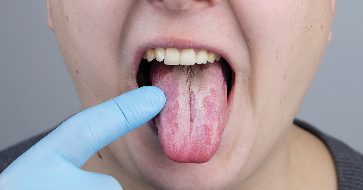 becca eastwood add rough oral photo